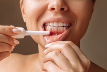 Periodontal Terapi