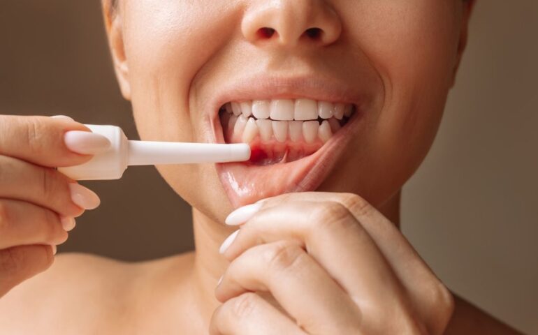Periodontal Terapi Nedir?