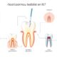 Endodonti Nedir